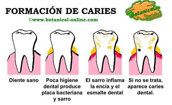 Esquema de la formación y causas de caries