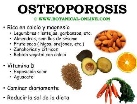 Resultado de imagen de osteoporosis dibujo