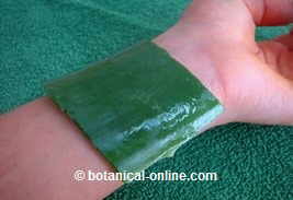 Aloe vera for skin burns