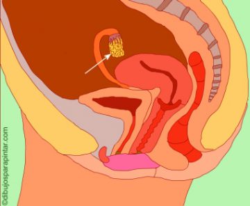 Drawing of a female reproductive system