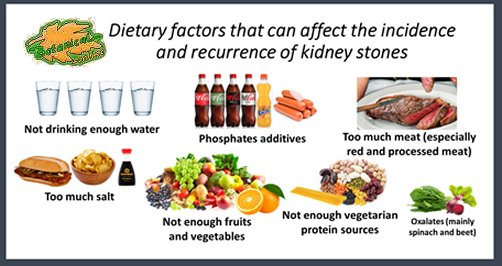 urinary stone risk factors