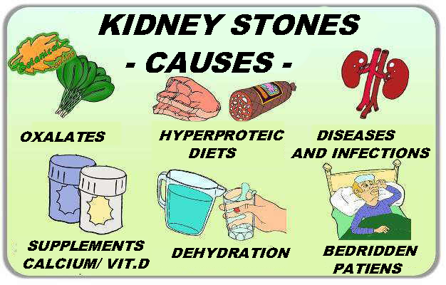 kidney stones causes
