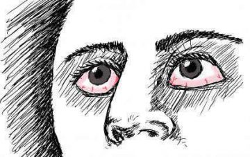 Red eyes