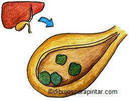 Gallbladder stones
