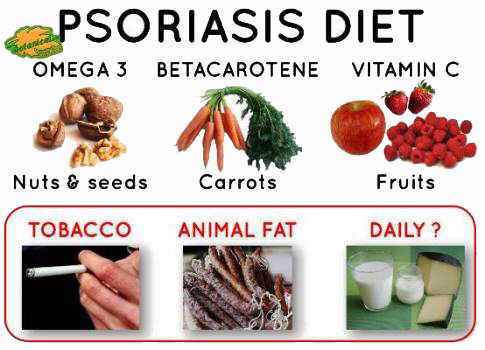 Psoriasis diet shop