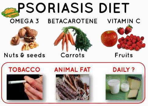 psoriasis diet nutrition foods