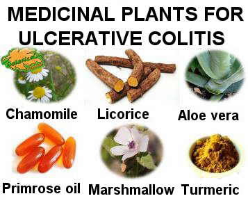 plants used in the natural treatment of ulcerative colitis