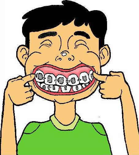 sonrisa