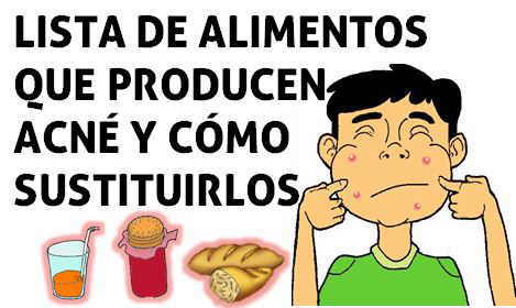 lista de alimentos que producen acne