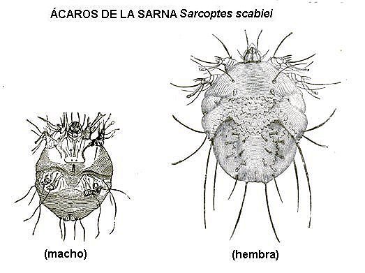 ácaro de la sarna