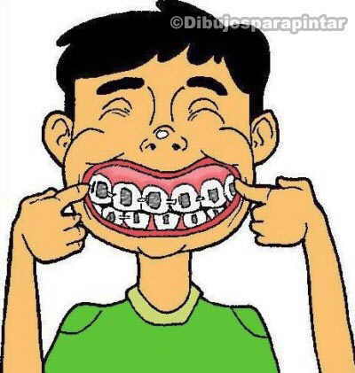 dibujo niño con brackets ortodoncia en los dientes