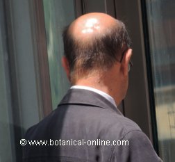 Falta de biotina puede producir caida del cabello