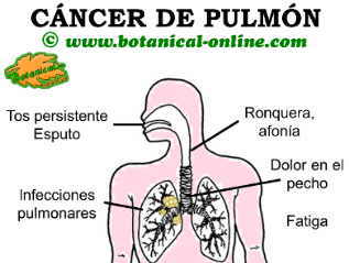 Sintomas de tener cancer en los pulmones