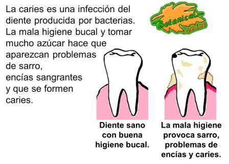 Caries dental