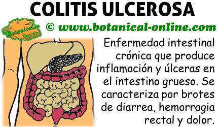 dieta para la colitis ulcerosa cronica