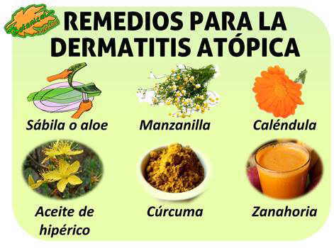 tratamiento con plantas medicinales y remedios naturales para la dermatitis atopica