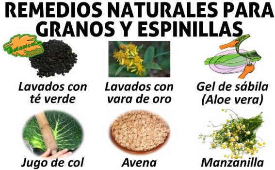 remedios naturales espinillas granos y acne