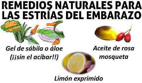 remedios estrias embarazo cremas aceites recomendados 