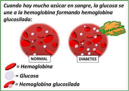 Dibujo ilustrativo de la formación de la hemoglobina glucosilada. Cuando hay mucho azúcar en sangre, la glucosa se une a la hemoglobina formando hemoglobina glucosilada hba1c en diabetes