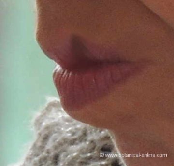 herpes labial
