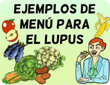 ejemplos menu lupus autoinmunes