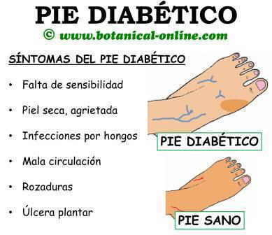 sintomas del pie diabético, palidez, rozaduras, durezas, ulcera plantar, mala circulacion, piel seca