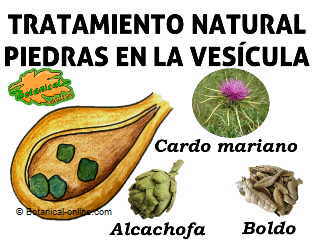 Que sintomas producen las piedras en la vesicula