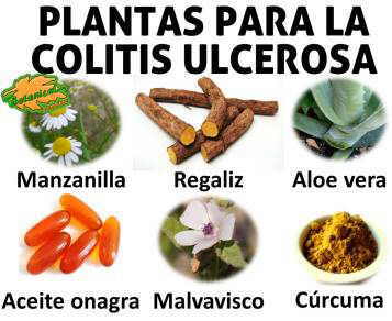 Remedios con plantas para el tratamiento natural de la colitis ulcerosa
