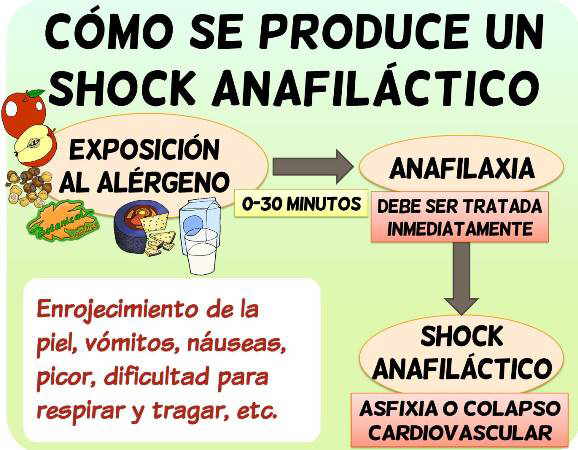 shock anafilactico alergia anafilaxia