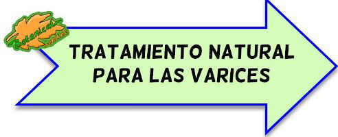 varices tratamiento